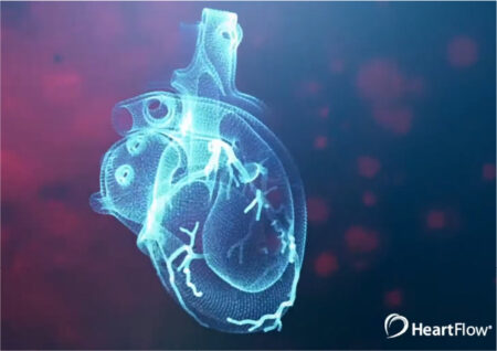 Платформа Heartflow подала заявку на IPO на $100 млн