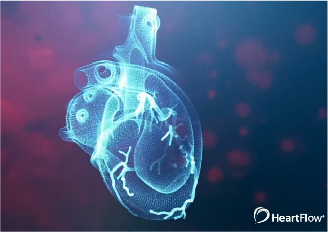 Платформа Heartflow подала заявку на IPO на $100 млн