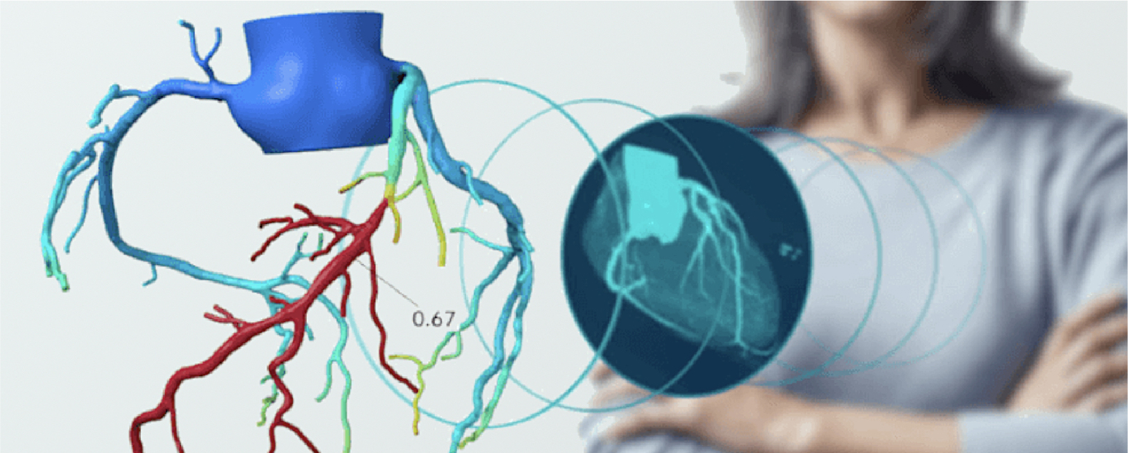 Оценка IPO Heartflow может быть повышена до $1,46 млрд