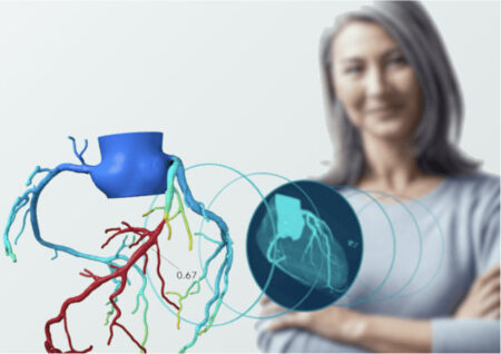 Оценка IPO Heartflow может быть повышена до $1,46 млрд