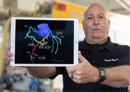 Heartflow стремится к оценке в $1,32 млрд на IPO после трех лет ожидания