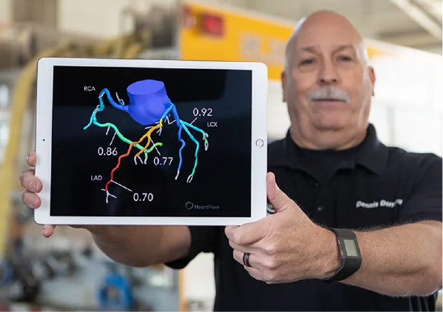 Heartflow стремится к оценке в $1,32 млрд на IPO после трех лет ожидания