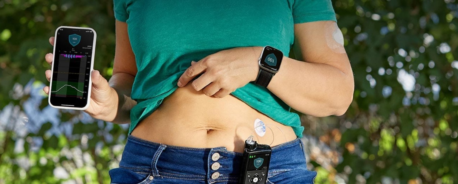 Medtronic выделяет в отдельное IPO диабетический бизнес с оборотом в $3 млрд